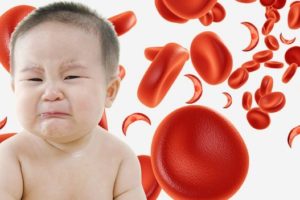 Penyebab HB Rendah atau Anemia pada Bayi